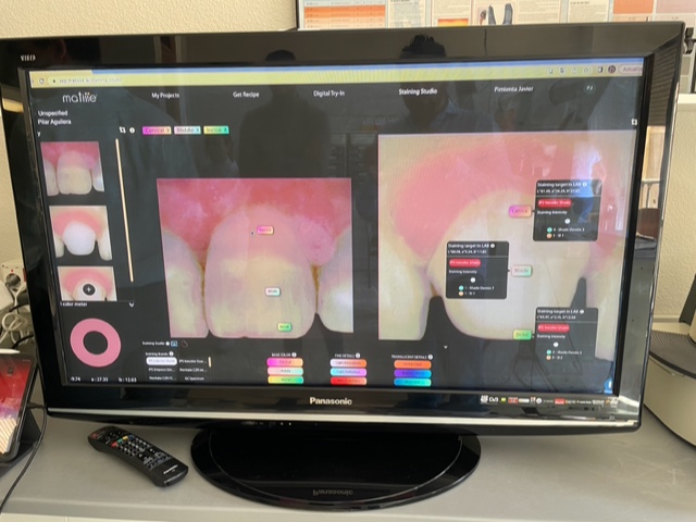 laboratorio-protesis-dentales-jaen-6