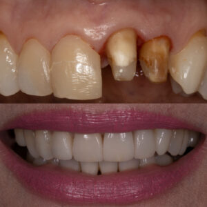 "Cliente en laboratorio de prótesis dental cercano